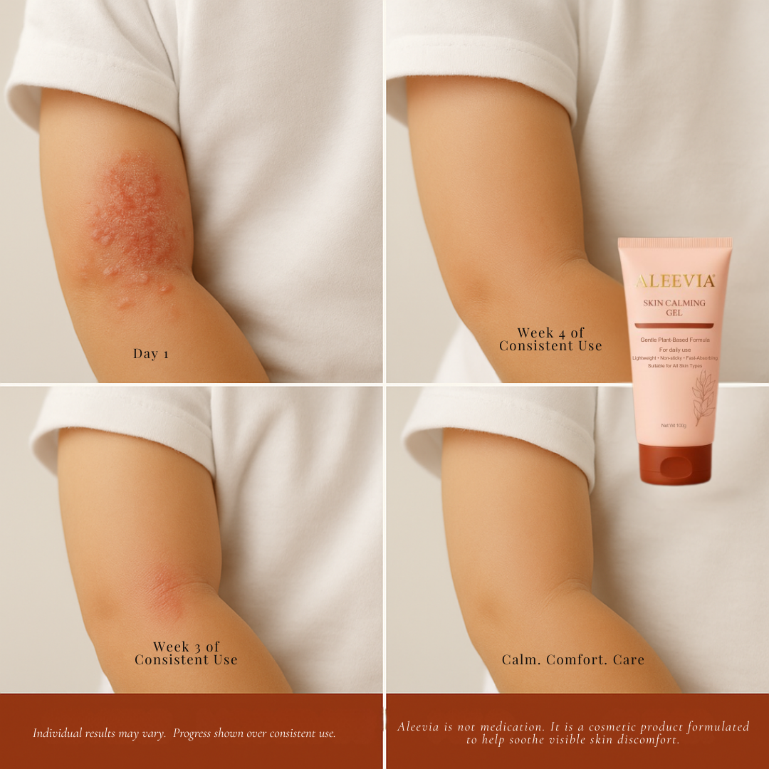 Arms and elbows before and after